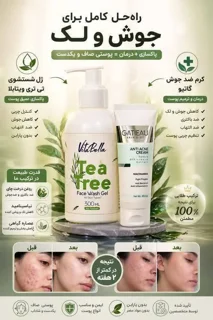 پک بیوممتیک ضد جوش و لک با کرم گاتیو و ژل شستشو ویتابلا